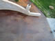 acid staining